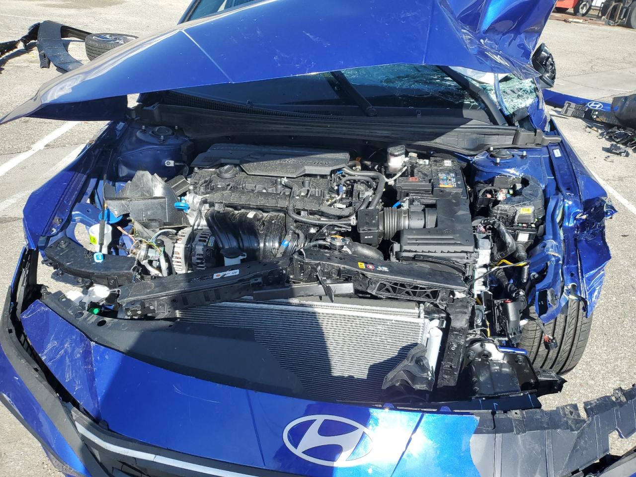 Hyundai ELANTRA Sel Sport Image 5